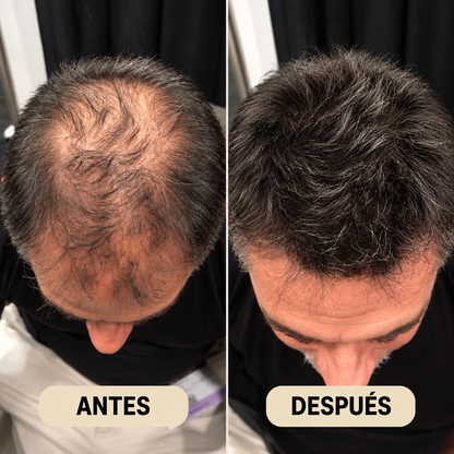 SHAMPOO ANTICAIDA MANPEAK