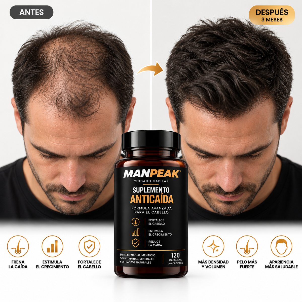 Manpeak - Capsulas Anticaida